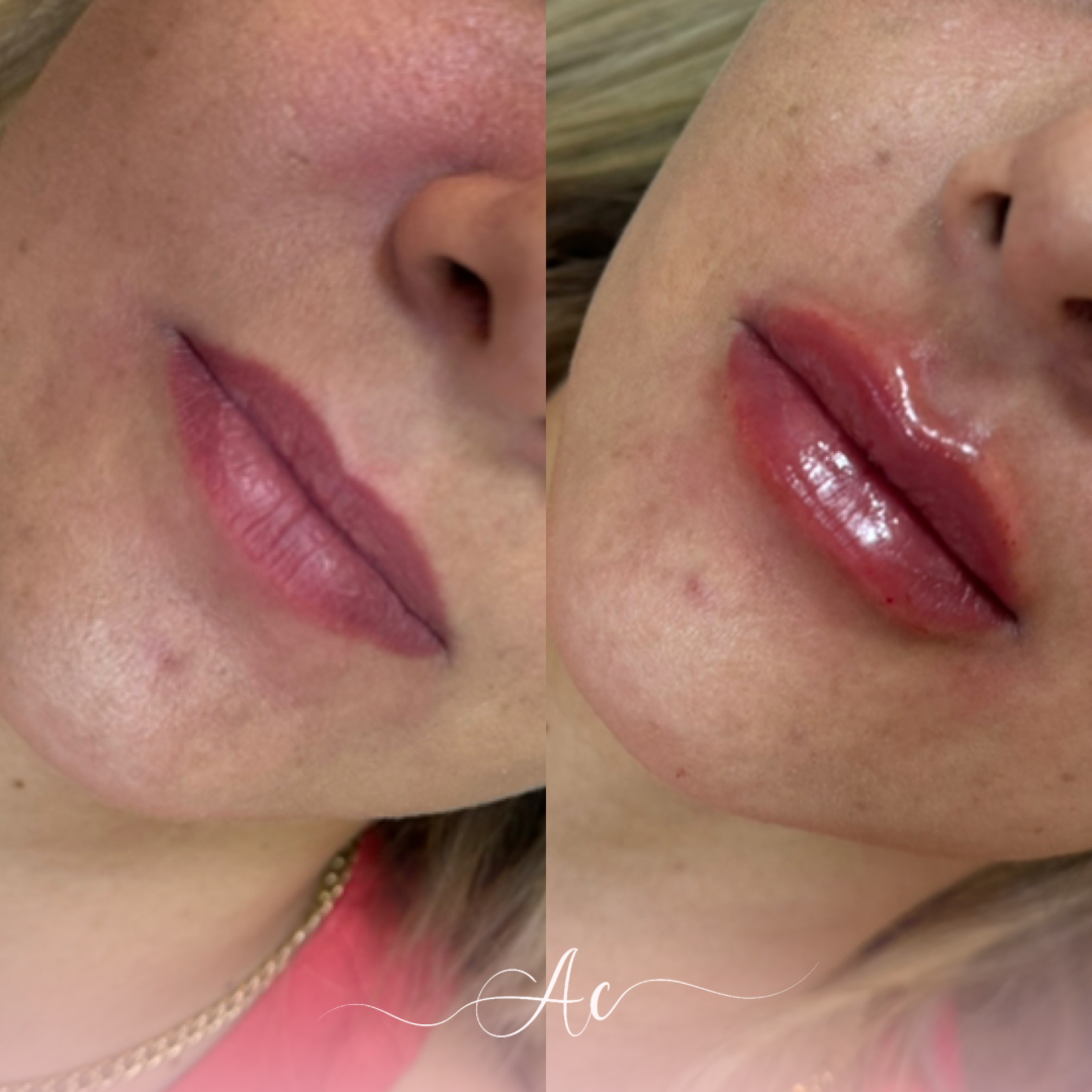 Resultados personalisados (Post do Instagram) - 13