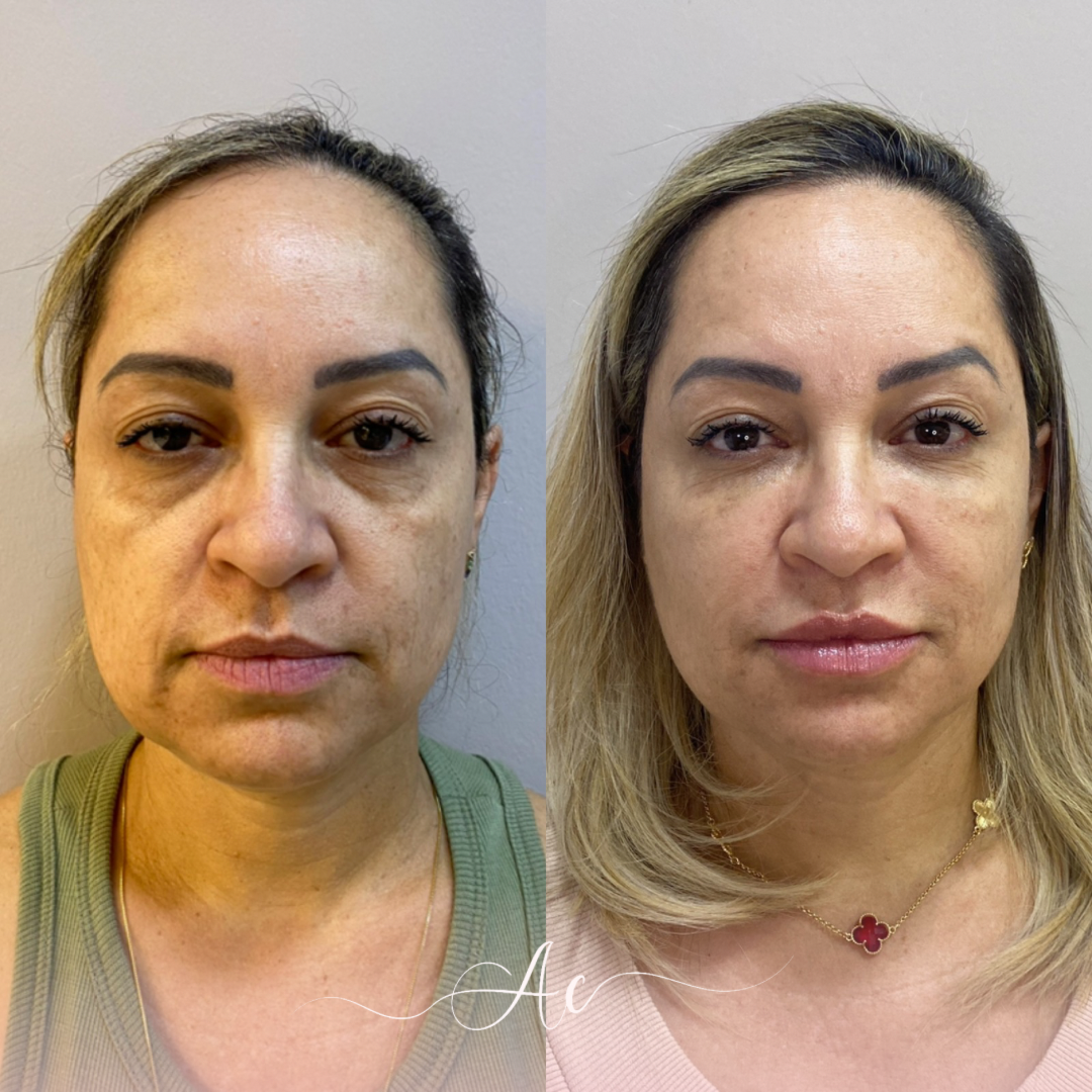 Resultados personalisados (Post do Instagram) - 15