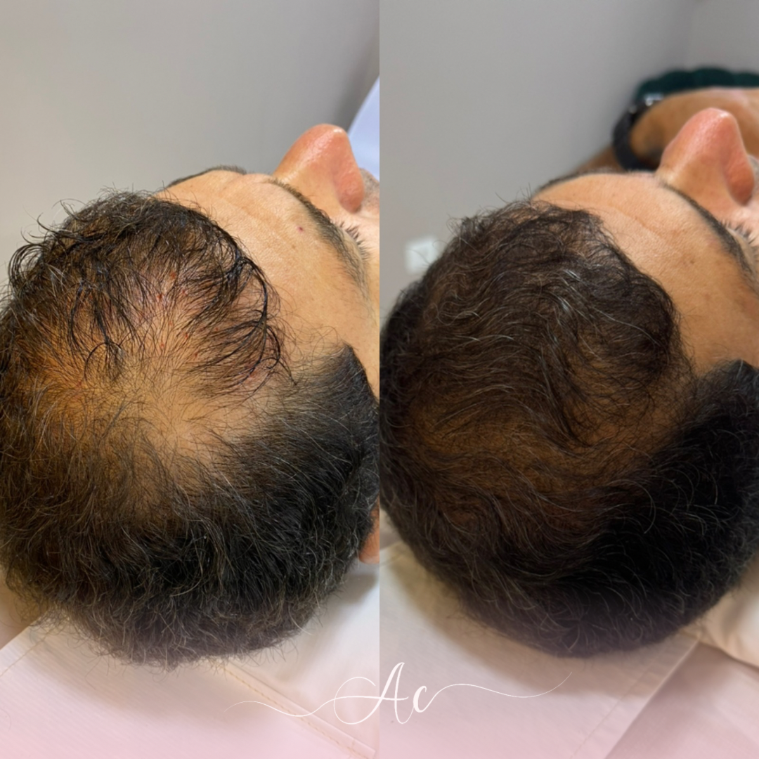 Resultados personalisados (Post do Instagram) - 16