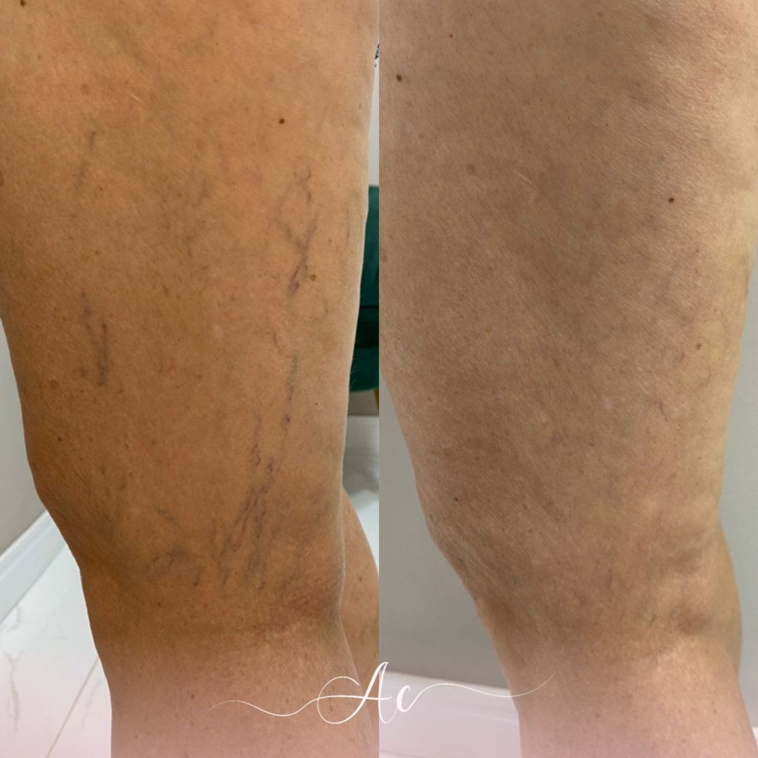 Resultados personalisados (Post do Instagram) - 18