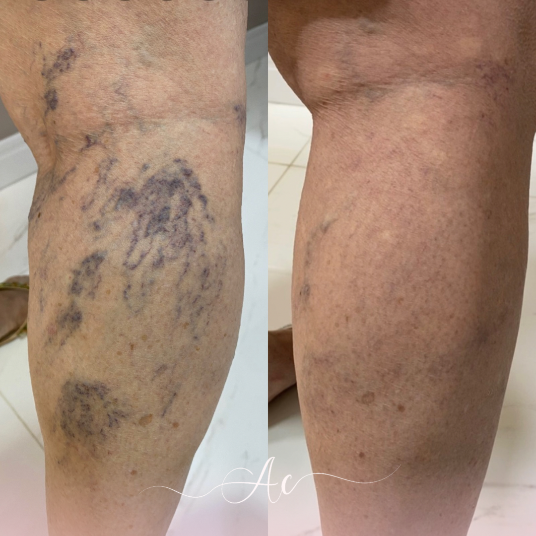 Resultados personalisados (Post do Instagram) - 19