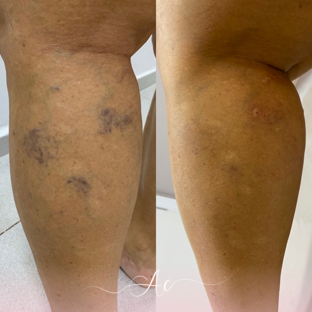 Resultados personalisados (Post do Instagram) - 20