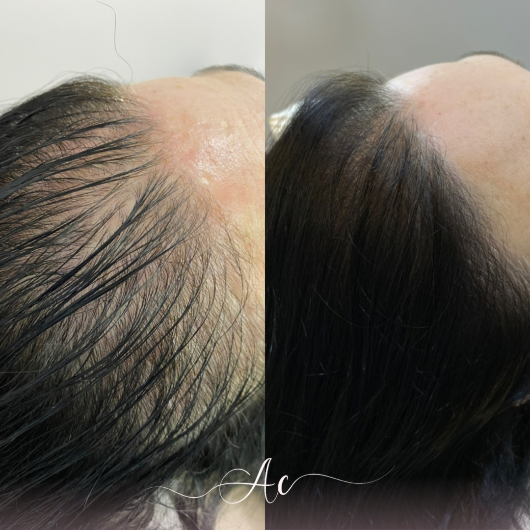 Resultados personalisados (Post do Instagram) - 21