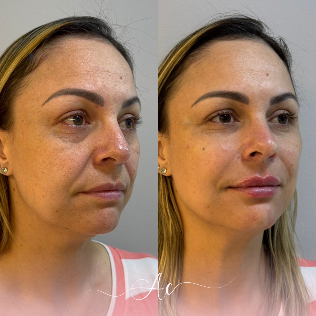 Resultados personalisados (Post do Instagram) - 22