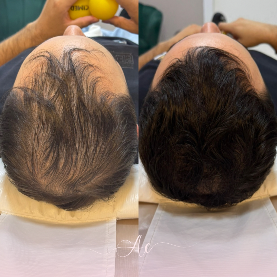 Resultados personalisados (Post do Instagram) - marca dagua assinatura (3)