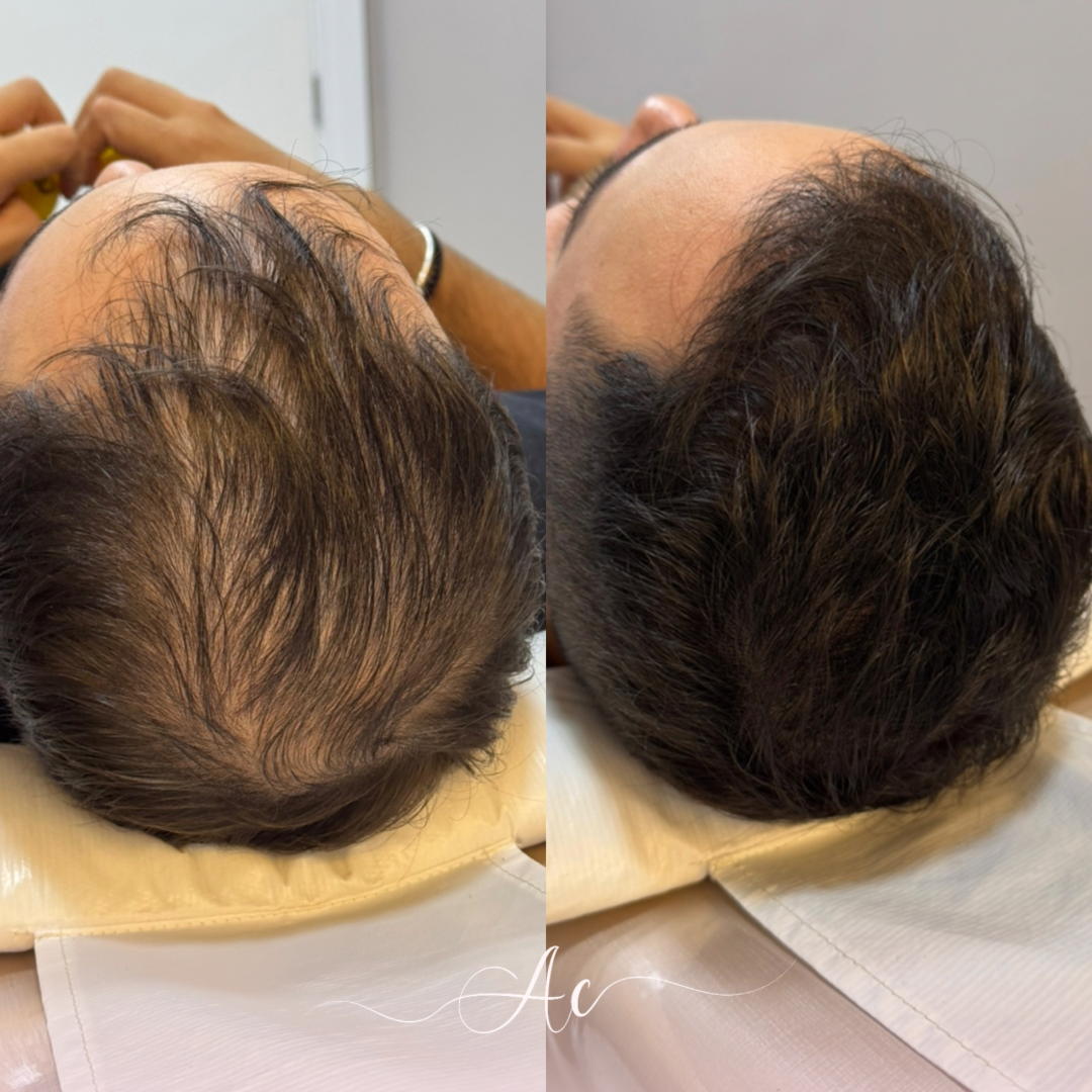 Resultados personalisados (Post do Instagram) - marca dagua assinatura (4)