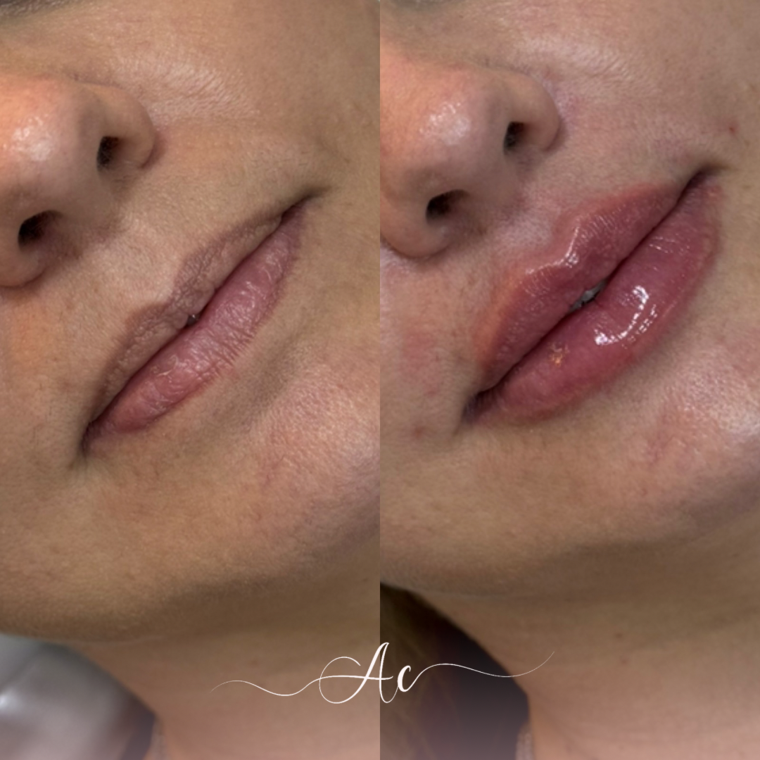 Resultados personalisados (Post do Instagram) - marca dagua assinatura (5)