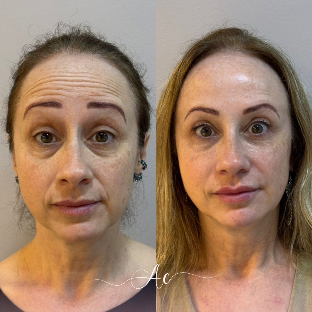 Resultados personalisados (Post do Instagram) - marca dagua assinatura (6)