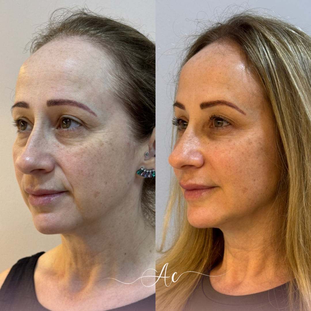 Resultados personalisados (Post do Instagram) - marca dagua assinatura (7)