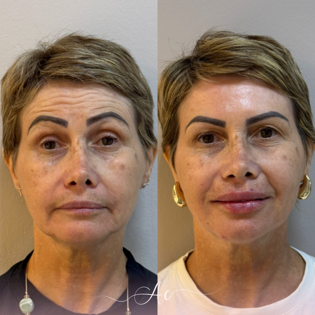 Resultados personalisados (Post do Instagram) - marca dagua assinatura (8)