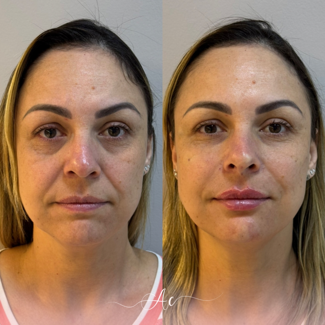 Resultados personalisados (Post do Instagram) - marca dagua assinatura (9)