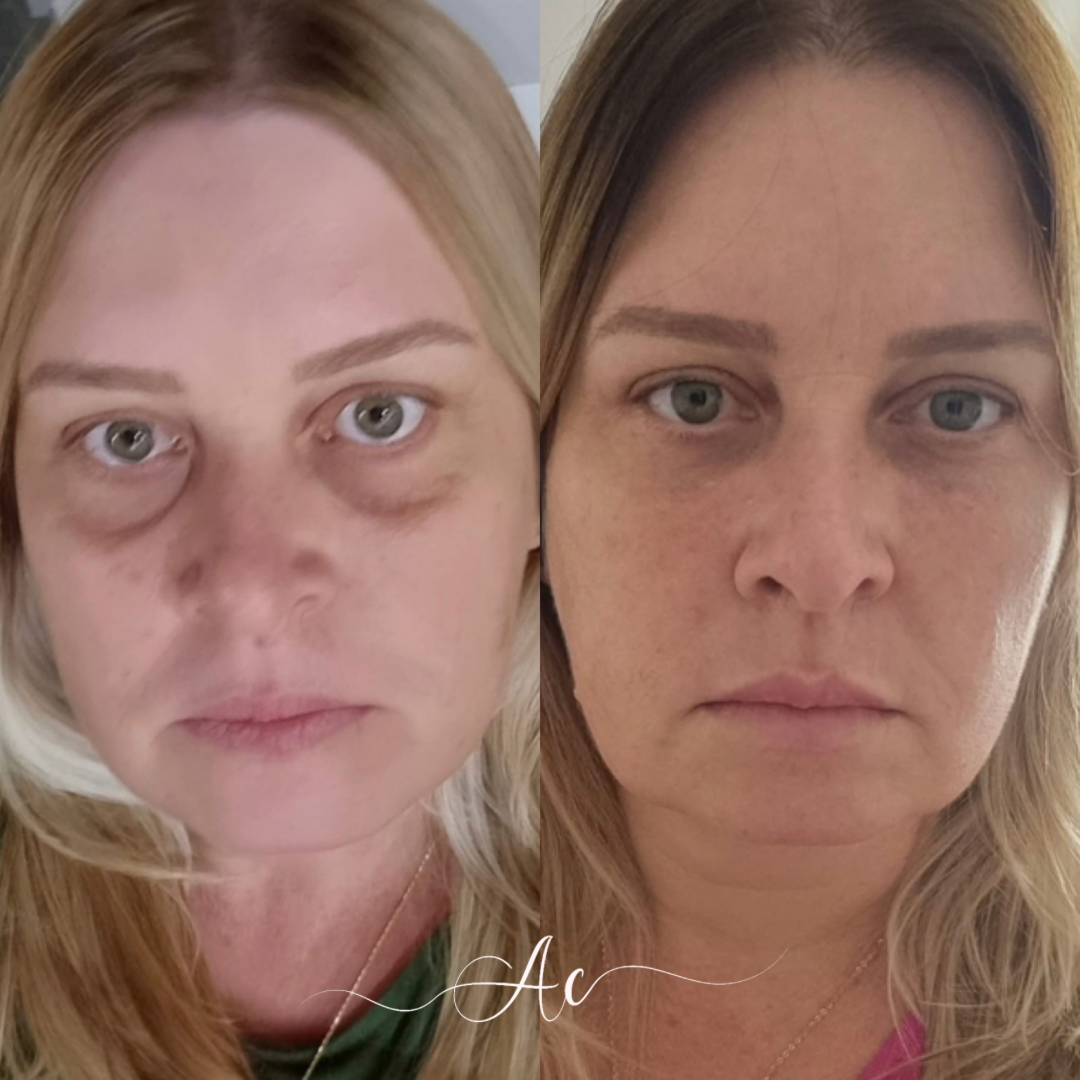 Resultados personalisados (Post do Instagram) - marca dagua assinatura